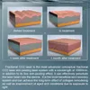 Tragbarer fraktionierter CO2-Laser, Wellenlängenerneuerung, Hong Kong vs. Pico-Laserlinse, Muttermalentfernung, Hautschönheitsbehandlung, Preis