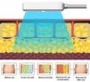 cryoskinセラピーボディスリミングクライオボディシェーピング4ハンドルEMS RF Cryolisys Plate Machine