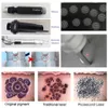 Picosekund och yag laser tatuering avl￤gsnande maskin kol skalsk￶nhet f￶r hudblekning