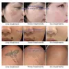 Portátil Pico a laser q interruptor a laser Remoção de tatuagem Picossegundo Máquina Pigmentos Terapia Equipamento de beleza