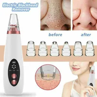 Face Massager USB Rechargeable Blackhead Remover Face Pore Vacuum Skin Care Acne Pore Cleaner Pimple Removal Vacuum Suction Tools 230526