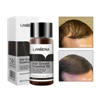Lanbena Fast Potente de crecimiento de cabello ESENCIA 2pcs evitando la calvicie consolidando la pérdida anti pelos nutridas para el cabello cuidados280m