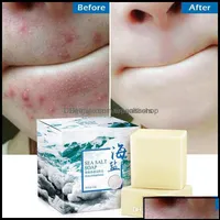 Handmade Soap Handmade Soap Bath Body Health Beauty 100G Removal Pimple Pores Acne Treatment Sea Salt Cleaner Goat Milk Moisturizing Otxcr