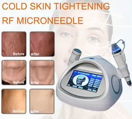 Novo 4 cartuchos fracionário rf microneedling rf máquina microneedle anti rugas acne cicatriz remoção de rádio freqüência equipamentos beleza