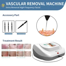 Máquina a laser pequenos navios em casa Use terapia de terapia vascular Vascular Removação da veia da aranha porta416