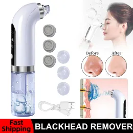 Removedores elétricos removedor de cravo sucção a vácuo facial poros acne limpador remoção de pele morta rosto limpeza beleza máquina cuidados com a pele ferramenta