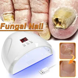 Tool Fungal Nail Laser Device Toe Nail Fungus Removal Fast Repair Nail Fungus Onychomycosis Toenail Fingernail Foot Care Cure Ingrown