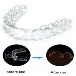 Dente ortodôntico treinador dental aparelho alinhamento cinta material de silicone profissional guarda toothstraightener