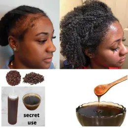 Schampookonditioner Africa Women Traction Alopecia behandling Hårtillväxtprodukt för män chebe pulver schampo håravfallsbehandling bli av med peruker