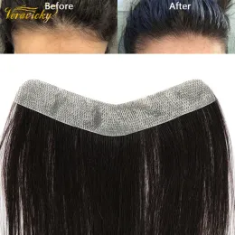 Toupees invisível linha fina testa biológico couro cabeludo remendo pele plutônio com fitas brasileiro natural cabelo humano remendo para calvície frontline