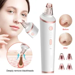 Ställer in elektrisk blackhead remover sugpor dammsugare IPL -behandling.