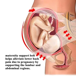 MATERNIZZAZIONE CURA DI CURA BANCHE BANCO DI BRACE SUPPORTO ADDOME ADDOMEN AGGIURABILE CINTURA DELLA CANTE DI BELLY AGGIORNABILE