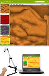 VF620 Infraröd ven Finder Viewer Handhold vuxna barn praktisk effektivitet ven locatorvein belysningsdetektor på olika 6478119