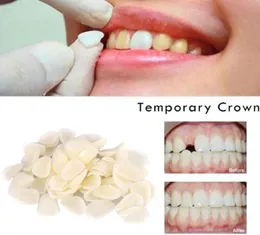 مواد طب الأسنان مختلطة التاج المؤقت القشرة الخلفية الأسنان منتجات الأسنان لتبييض الأسنان