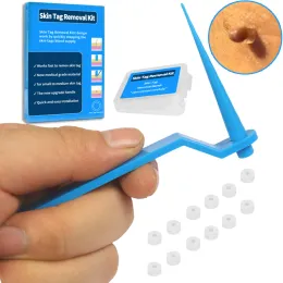 Инструмент 1 Set Medical Skin Tag Kill Mole Wart Remover Micro Band Kit с чистыми мазками для взрослых