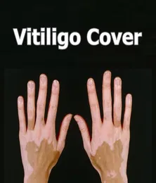 Vitiligo concealer flytande penna vattentät vitiligo lappar naturliga dölj leukoderma omedelbar makeup täckande lösning för hudstörning3053001
