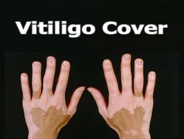 vitiligo 컨실러 액체 펜 방수 vitiligo 패치 자연 숨기기 백혈병 인스턴트 메이크업 피부 질병에 대한 솔루션 4629840