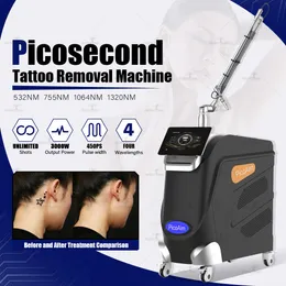 PerfectLaser Professional Picosecond Machine entfernt Tattoos Picosekunden -Laser -Tattoo Entfernung Pico Laser Hautpigmentierungsentfernung Gerät
