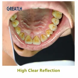 Зеркала стоматолога для пероральной фотографии зеркал