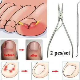 Ingrown Toenails Pedicure Foot Care Tool Nail Correction Clipper Futters For Orthotic Acronyx Dead Skin Remover Podiatry