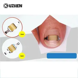 도구 1 세트 내향성 발자레 조정기 도구 페디큐어 전문 내향 발톱 발병 복구 복구 embed Toe Nail Treatment