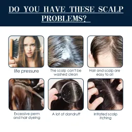 TRATTAMENTO CURALLA Essenza Spray Cleansing Nutrishing Anti Dandruff Repair prudente Prevenire la cura dei capelli lisci per gli uomini donne