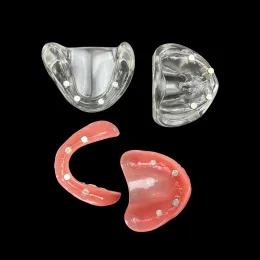 Modello di impianto dentale rimovibile rimovibile demo mandibolare overdenture mascella superiore/inferiore con 4 impianti prodotti di odontoiatria