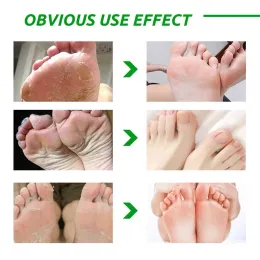 Aloe Vera Foot Mask che peeling per le gambe Maschera dei piedi Exfoliating Calzini Scrub per pedicure Anti Crack Tagino Rimuovi la toppa del piede per la cura della pelle