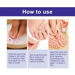 Essenza di riparazione delle unghie 10 ml di riparazione delicata per unghie unghie liquide rivitalizzanti unghie liquide proteggere strumento per la cura delle unghie naturali essenza