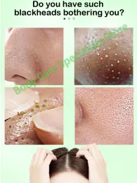 Maschera rimodellamento del naso Blackhead Mask Curanti profondi per cura della pelle per la cura della pelle Acne Treatment Mask Black Pore Black Pore Clean