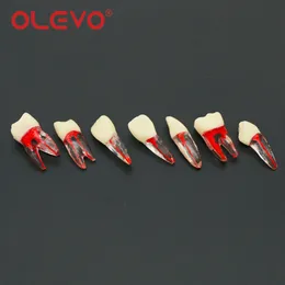 OLEVO 5 Pcs Dental Endo Blocks Endodontic RCT Root Canal Training Model Pulp Files Resin Teeth Practise Dentistry Teaching