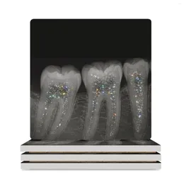 Bordmattor Dental röntgen med glitter keramiska dalbanor (fyrkant) dekoration och tillbehör kreativ dryck set