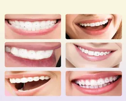 Permanente Make -up -Tinten Zahngestein Set Einfach zu entfernen Schöner weißer Schmuck Reflektierende Zähne Ornament Application Kit für Mädchen 22116478742