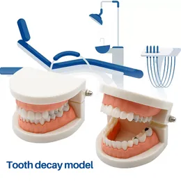 1 st barn barnstudie hålighet modell tandläkare undervisning tänder modell tandläkare laboratorium tandläkare studie med förfallen tand