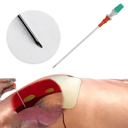 2024 Rettungsspannung Pneumothorax Access Kit Sterilisierte Karosserie Piercing -Nähpunktion Dekompressionsnadeln für Ersthelfer