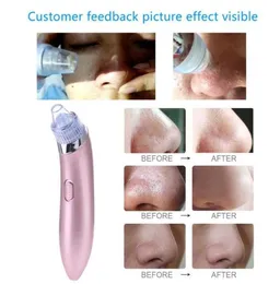 Gesichtsporenreiniger Blackhead Remover Schwarze Flecken Punkte Poren Vakuum Comedo Saugbehinderung Pickelentferner Tool1248475