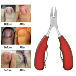 As Clippers de unhas Remova a correção de unhas da pele morta Cenas de unhas encravadas da unha da cuticle cuticle scissor borda cortador de pedicure grossa ferramenta