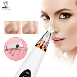 Scrubbers Elektrische Gesichts Blackhead Remover Vakuum Poren Reiniger Nase Face Tiefe Reinigung Hautentfernung Akne Pickel Pflege Hine Schönheit Werkzeug