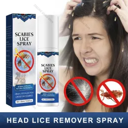 Tratamentos 30 ml Remoção de piolhos Spray crianças adultos Remoção preventiva para ovos de piolhos NITS Promove cabelos livres de piolhos se livram de pulgas