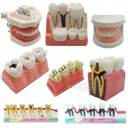 Toothbrush Dental Teeth Model Teaching Plant Decay Tooth Brushing Training