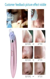 Face Pore Cleaner Blackhead Remover Black Spots Dots Pore Vacuum Comedo Suction Facial Cleaning Pimple Remover Tool9726670