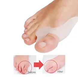 new 2pcs Silicone Gel Thumb Corrector Bunion Little Toe Protector Separator Hallux Valgus Finger Straightener Foot Care Relief Pads foot