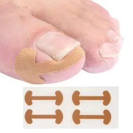 Tool 20pcs Professional Ingrown Toenail Foot Corrector Stickers Elasticity Toe Nail Care Pedicure Tools Health Care Protects Toe Nail