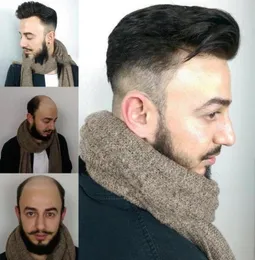 7x9 koronki toupee Mens System Abansit Włosy Zagubione w stylu grzebienia