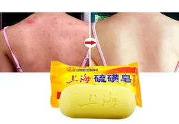 85g Shanghai Sulfur Soap Oil Control Acne Treatment Psoriasis Seborrhea Eczema Anti Fungus Bath Healthy Soap4528421