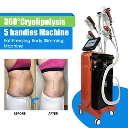 Salon Fat freeze machine separatore di grasso attrezzature per il viso di bellezza 5 maniglie disponibili