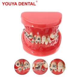 Other Oral Hygiene Dentist Dental Orthodontic Treatment Model With Ceramic Metal Bracket Resin Orthodontic Teeth Model Ortho Tooth Teaching Models 230815