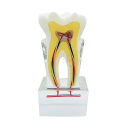 Inna higiena jamy ustnej 1PCS Nerw dentystyczny anatomia nauczania Model zęba sześciokrotnie patologiczne zęby zębów zębów zębów zębów
