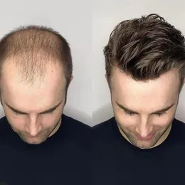 Newest Men's Wig Super Fine Swiss Lace Men Toupee 8x10 Inches Brazilian Human Hair Prosthetic Male Wigs 263a