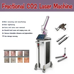 Remoção de tatuagem a laser CO2